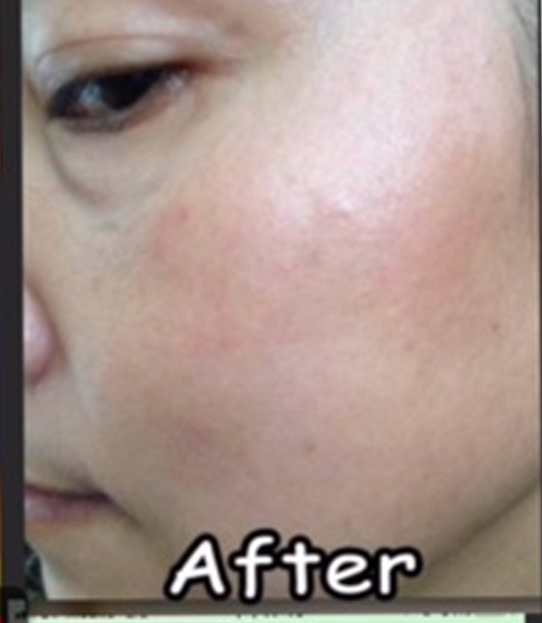 after after