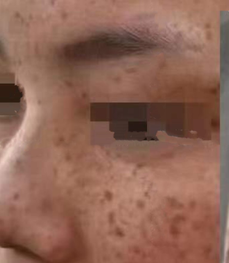 img1