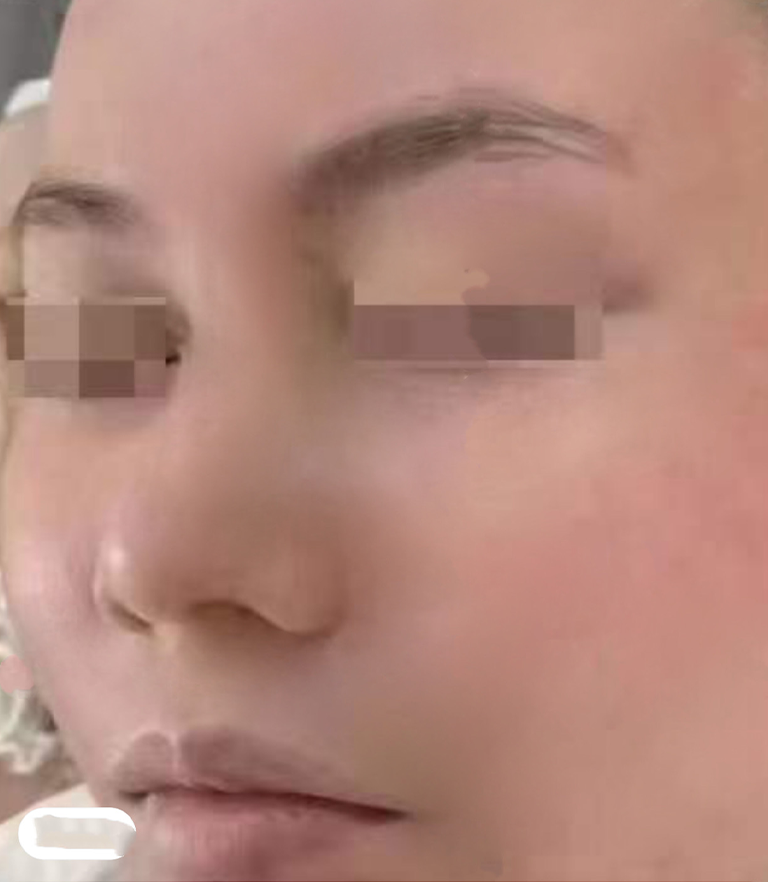 img2
